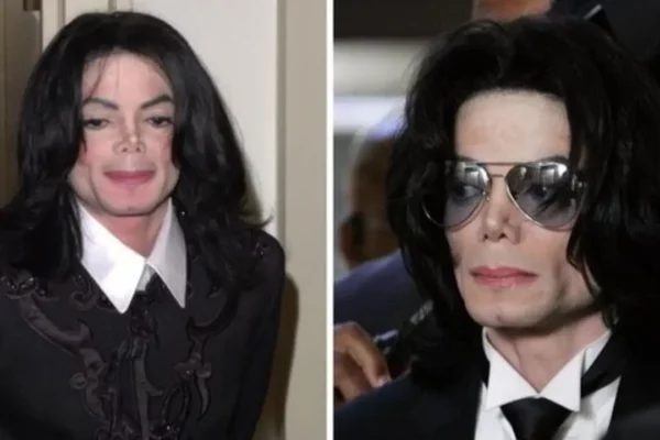 How did Michael Jackson die